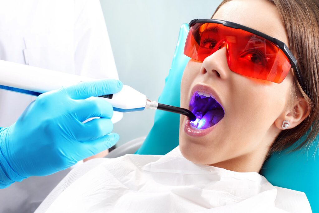 Dental Bonding at Oakwood Dental